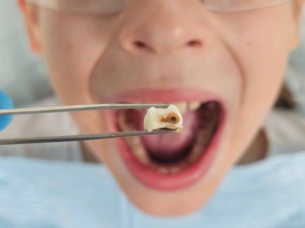 Best Emergency Pediatric Dental Care in Nichols Hills, OK